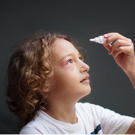 a young boy with pink eye drops eyedrops into his eye